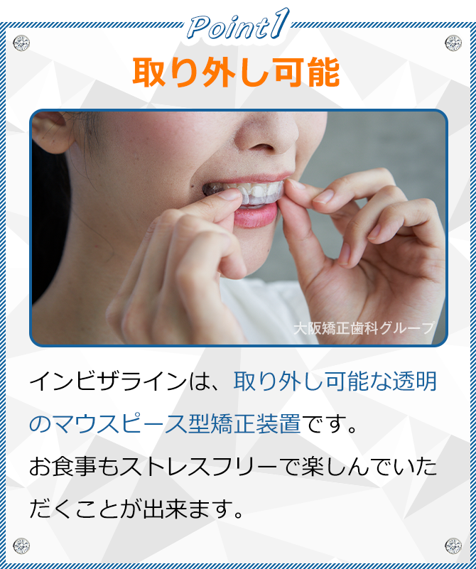 取り外し可能